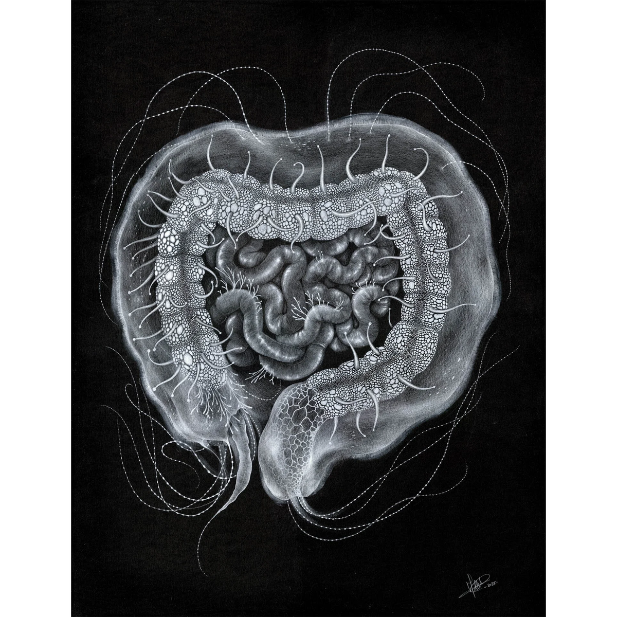 Apolemia